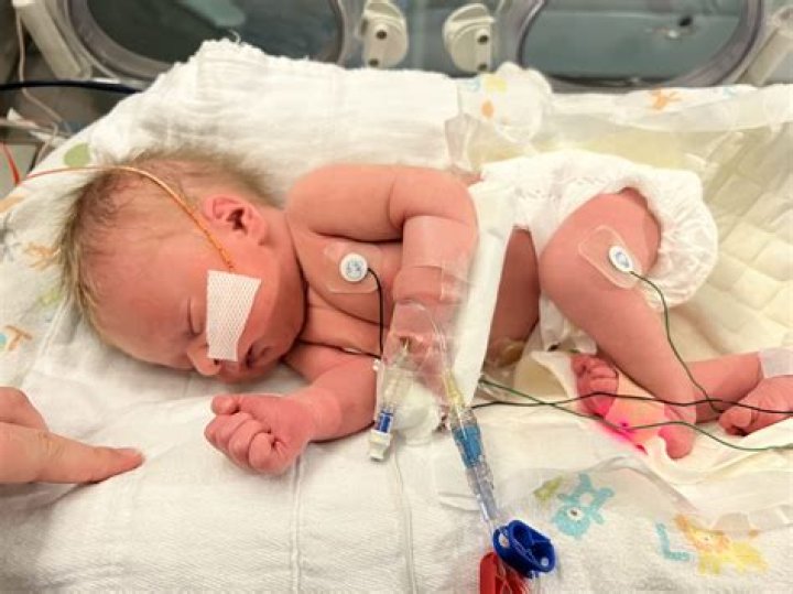 Boris Kodjoe's Daughter's Journey With Spina Bifida