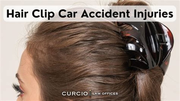 Claw Clip Car Accidents Exposed