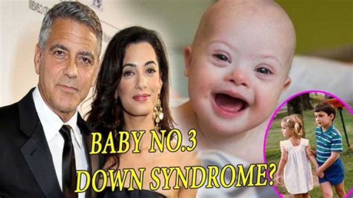 Does George Clooney's Child Have Down Syndrome? Exploring the Truth Behind the Rumors