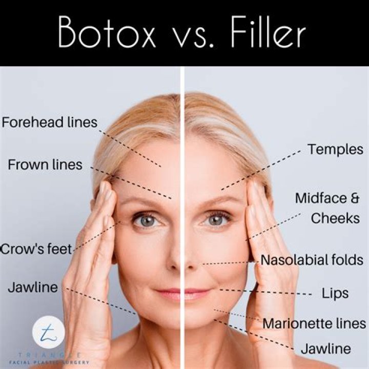 Exploring Botox And Plastic Surgery Rumors