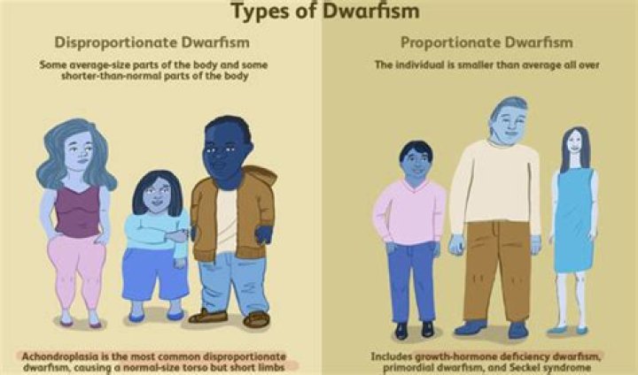 Exploring The Rarest Forms Of Dwarfism