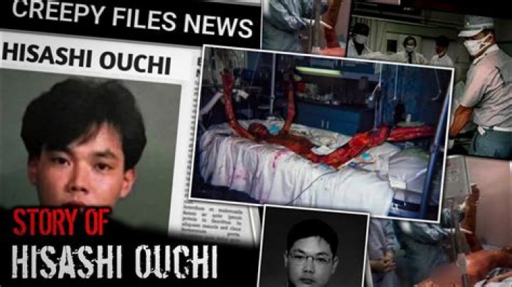 Hisashi Ouchi Photos: A Deep Dive into the Life and Story of a Tragic Incident