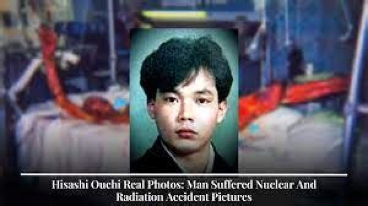 Hisashi Ouchi: The True Story Behind the Real Photos and Tragic Fate