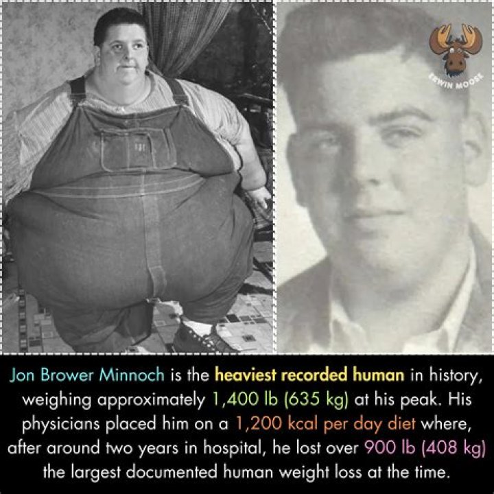 Jon Brower Minnoch: The Story of the Heaviest Man in Recorded History