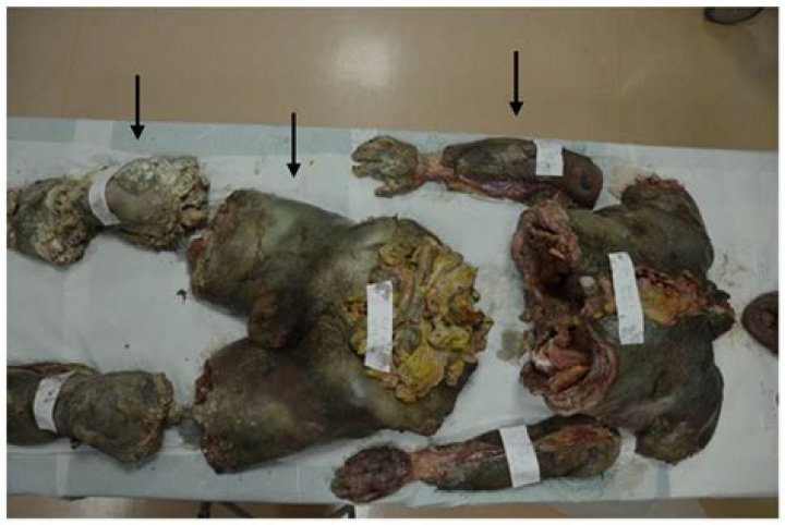 Karlan Denio Crime Scene Photos: Exploring the Impact of Crime on Society