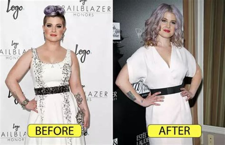 Kelly Osbourne Before and After: A Journey of Transformation and Resilience
