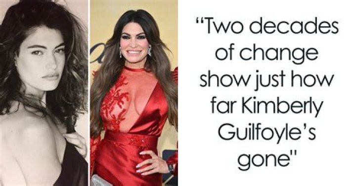 Kimberly Guilfoyle Face Lift: Everything You Need to Know About Her Transformation