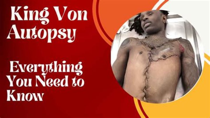 King Von Autopsy Photos: A Deep Dive into the Life and Legacy of a Rap Icon