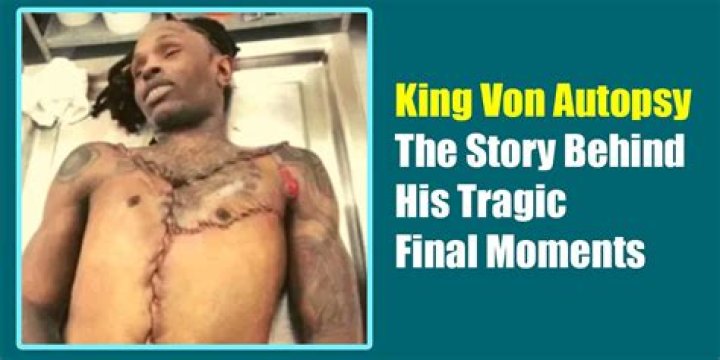 King Von Autopsy: Unveiling the Truth Behind His Death