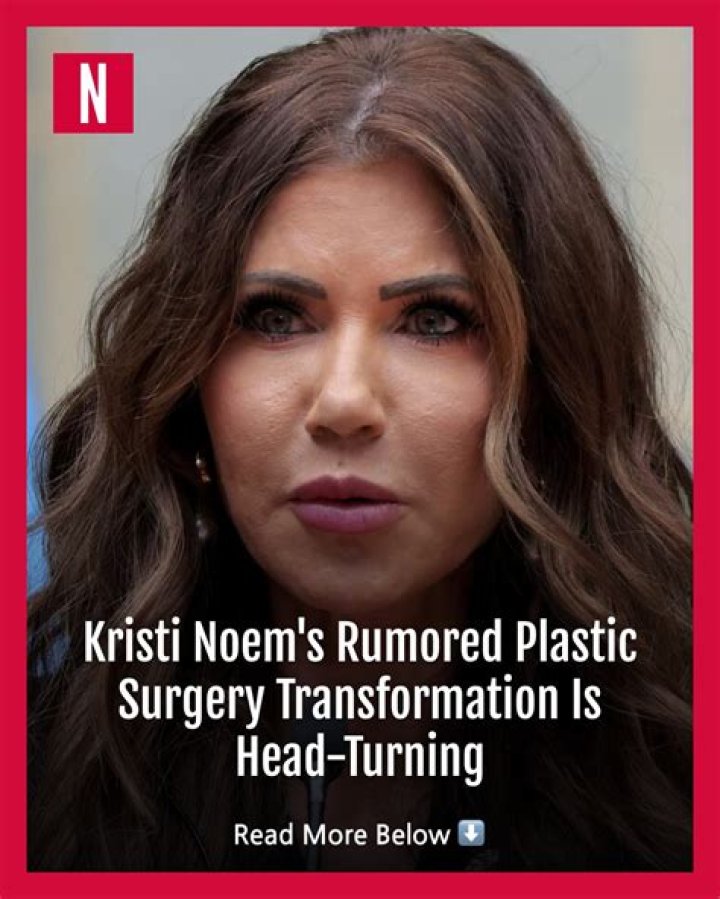 Kristi Noem Plastic Surgery: The Truth Behind the Speculations