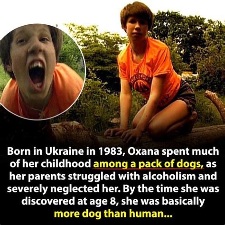 Oxana Malaya: The Ukrainian Feral Child Who Captured the World's Attention