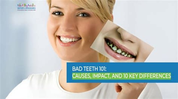 The Impact Of "Bad Teeth" In The World Of Acting