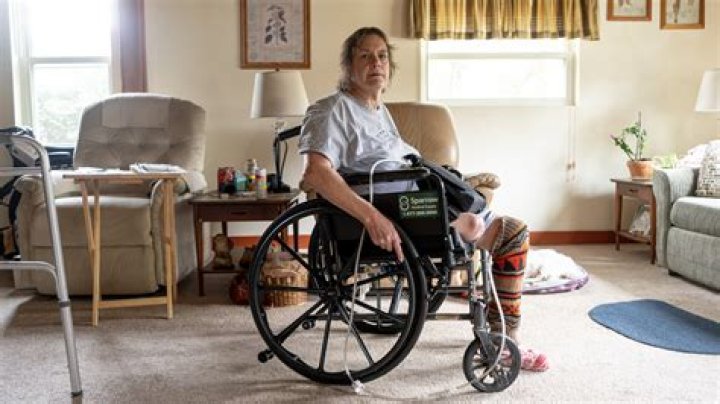 Uncovering The Surprising Link To Amputation