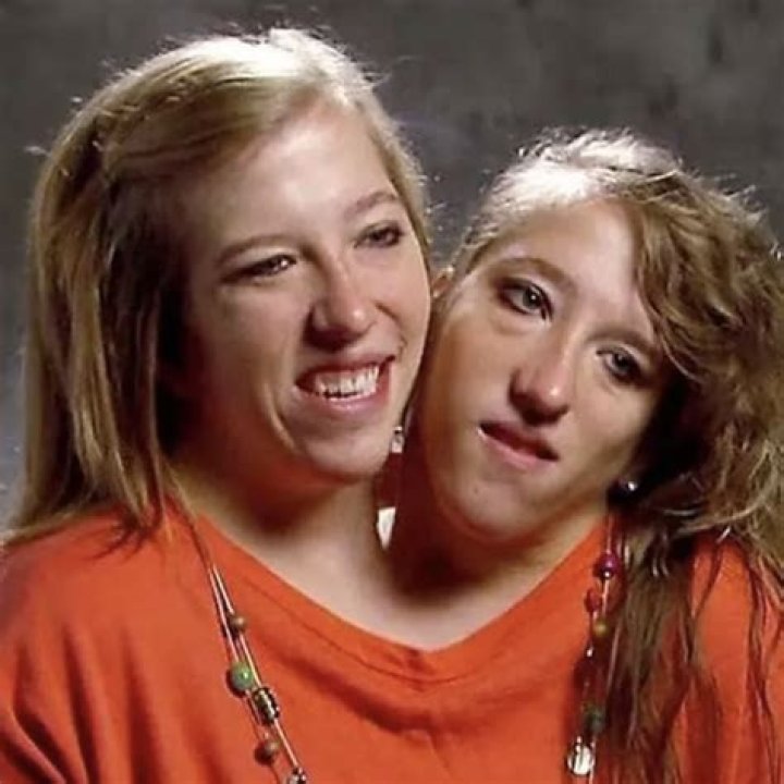 Understanding the Lives and Legacy of Conjoined Twins Abby and Brittany Hensel: What Happened to Them?
