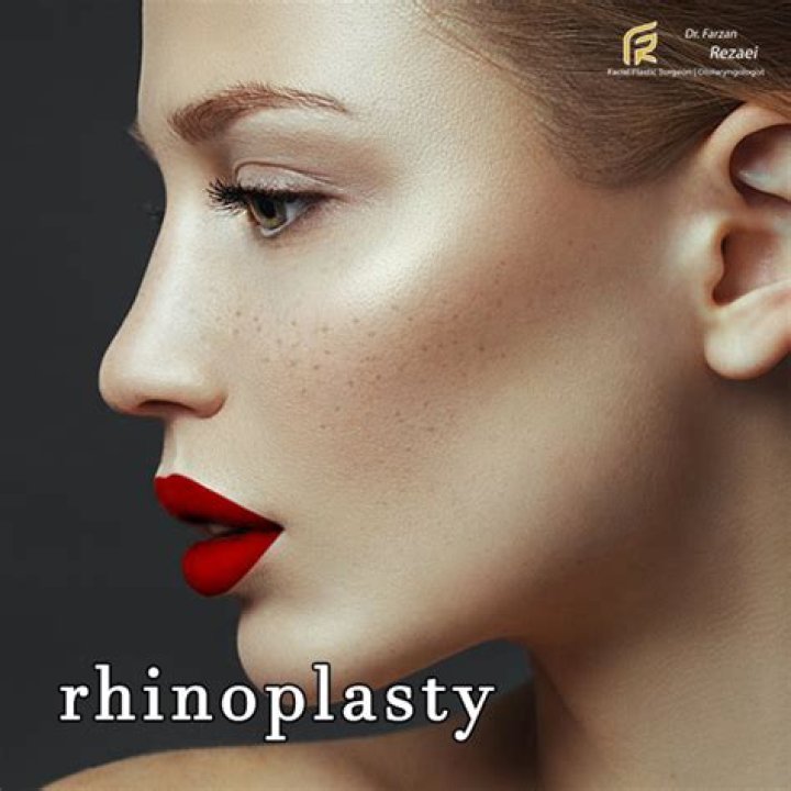 Unlocking The Secrets Of Rhinoplasty