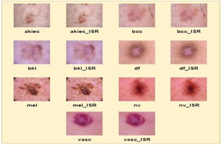 Unraveling The Secrets Of Skin Cancer Treatment With Dr. Roach Judd