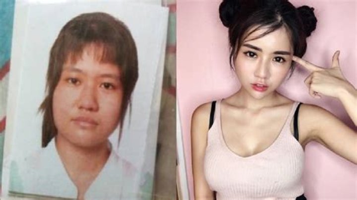 Unveil The Transformation: Kiaraakitty Before Plastic Surgery