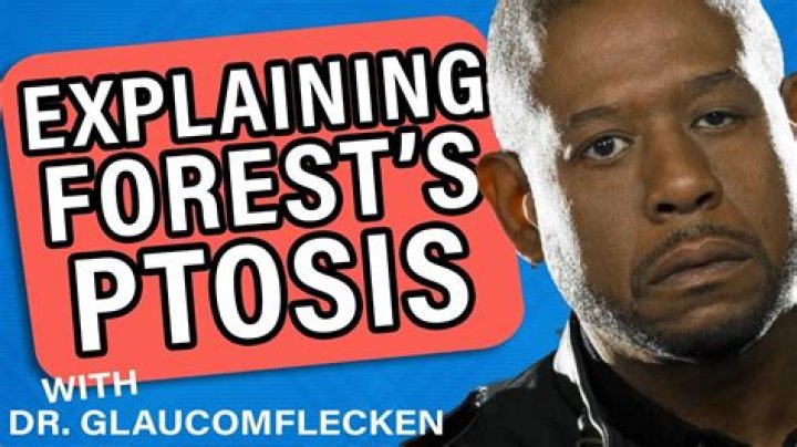 Unveiling The Enigmatic Eye Of Forest Whitaker: Discoveries And Insights