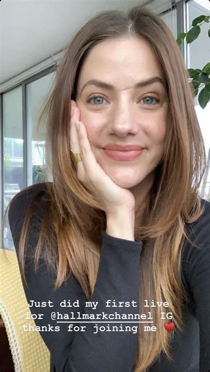Unveiling The Secrets Of Julie Gonzalo's Face Scar: Discoveries And Insights