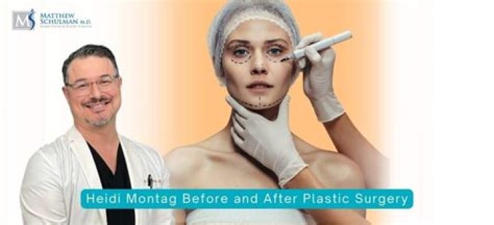 Unveiling The Truth Behind Heidi Montag's Plastic Surgery Journey