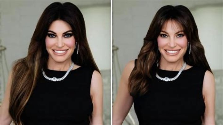 What Did Kimberly Guilfoyle Do to Her Face? A Comprehensive Look at Her Transformation