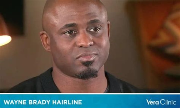 What Happened To Wayne Brady Hair? Hairline And Baldness Explored